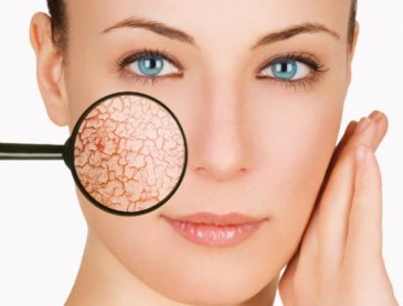 ikm dermatolog